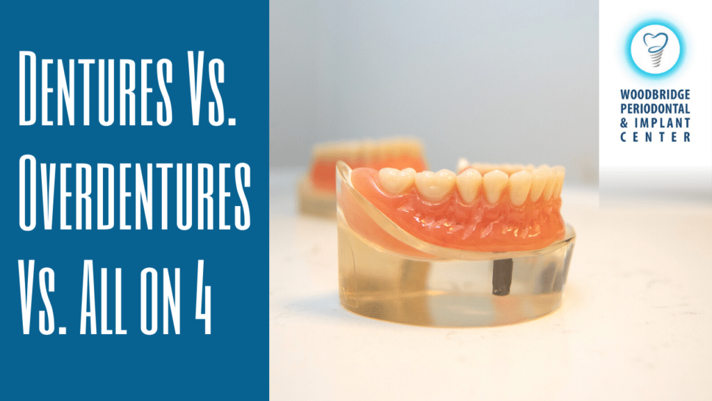 Costs For Dental Implants Washington District Of Columbia