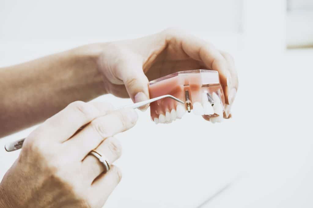 Costs For Dental Implants Miami Gardens Florida