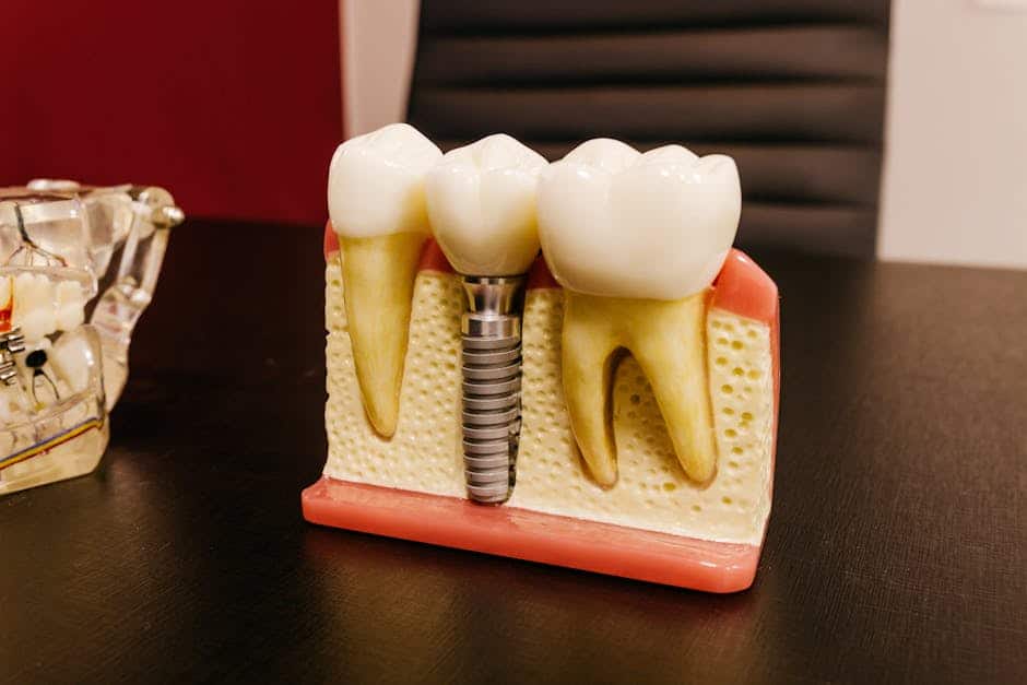 Costs For Dental Implants In Miramonte Frisco Texas