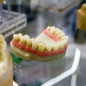 Photo Tooth implant
