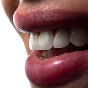 Photo Titanium implant