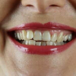 Photo "Best Dental Implants Coachella California"