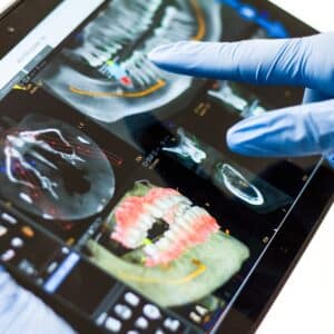 Photo Dental implant