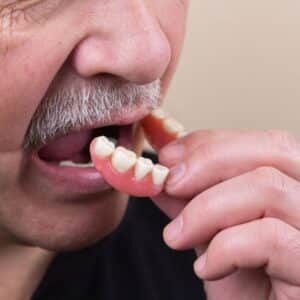 Photo Dental implant