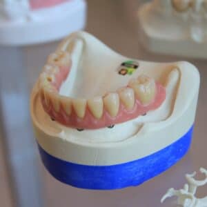 Photo Dental implant brush