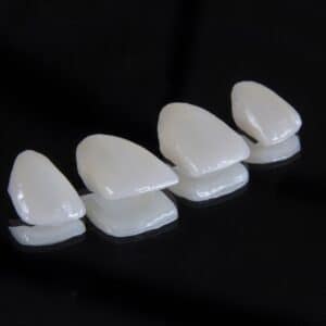 Photo Tooth implant