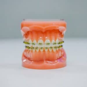 Photo Swollen gums