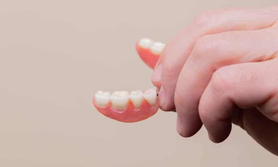 Dental Implant Payment Plans