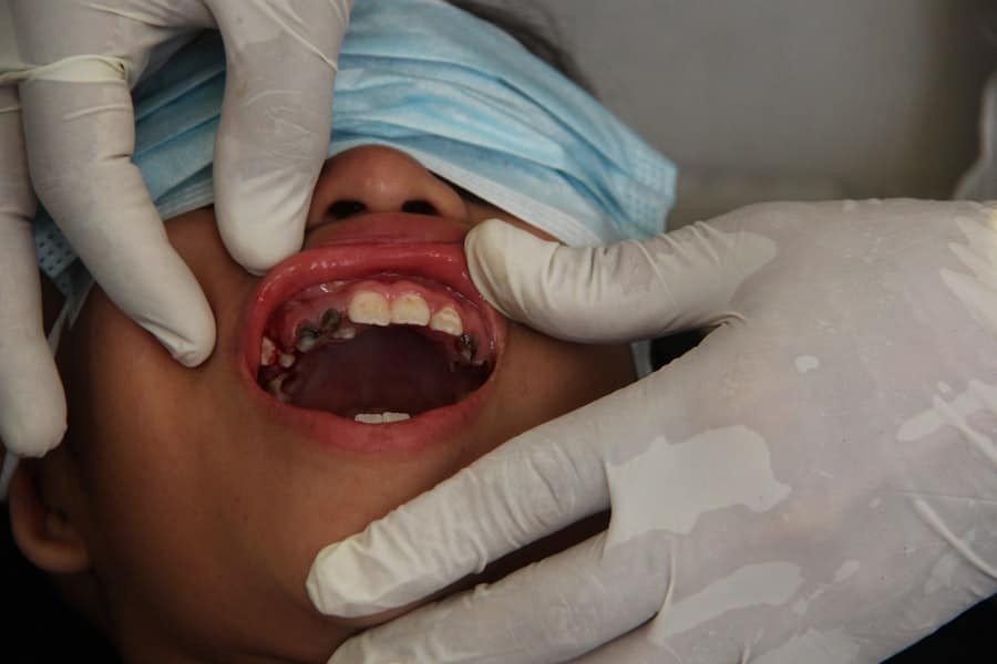 Cosmetic Implant Dentist