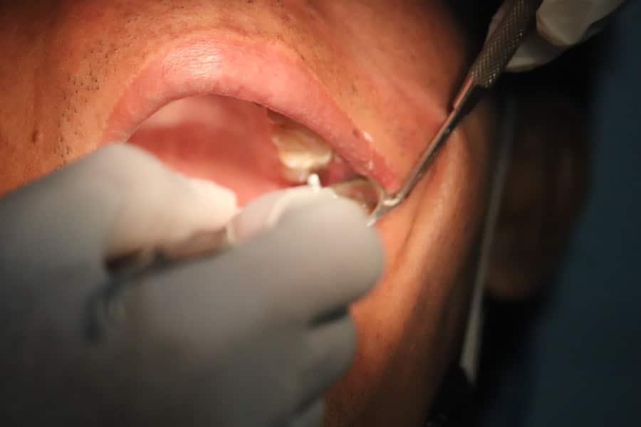 Dental Implant Special Offer Chandler Az
