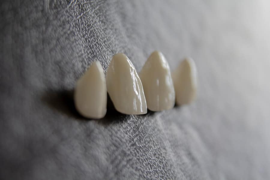 Dental Implant Cost