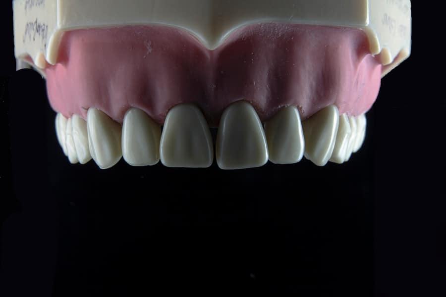Dental Implant Process Timeline