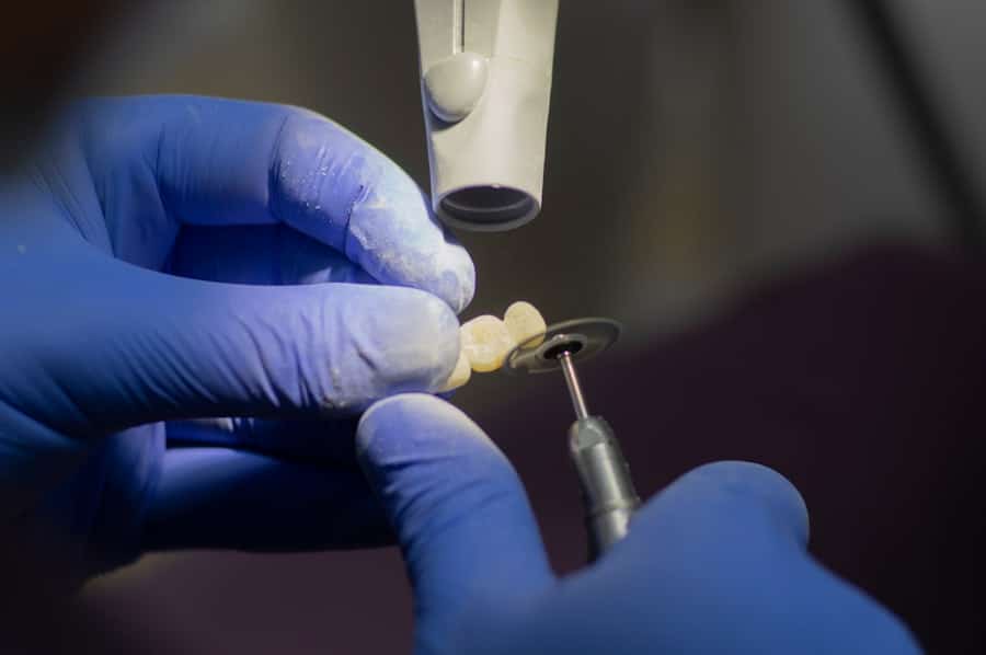 Affordable Implant Clinic