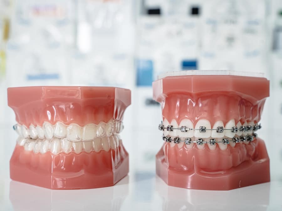 Dental Restoration Cost