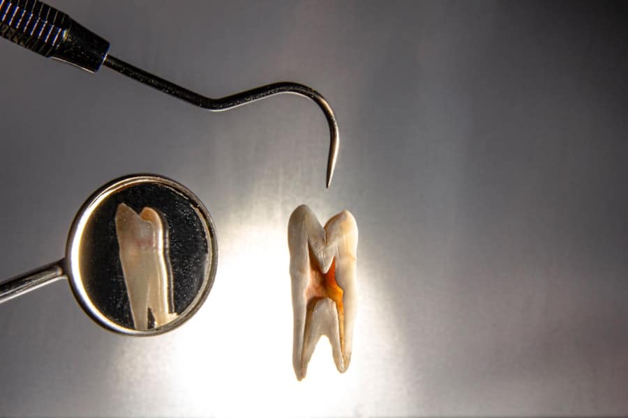 Dental Implant Dentist
