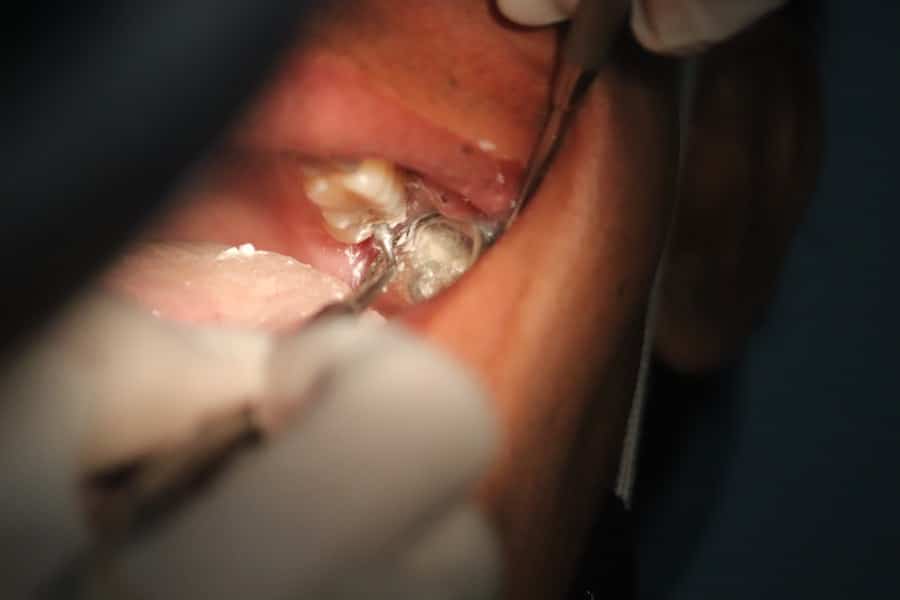 Dental Implant Clinic
