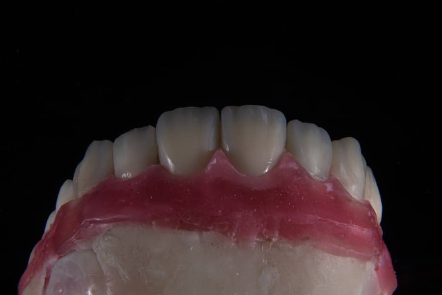 Implant Dentist