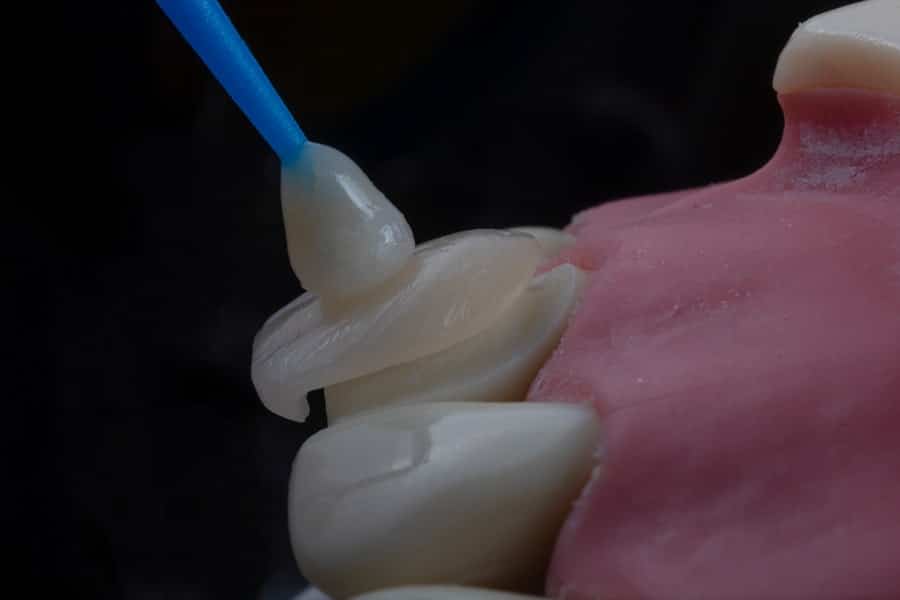 Dental Clinic for Implants