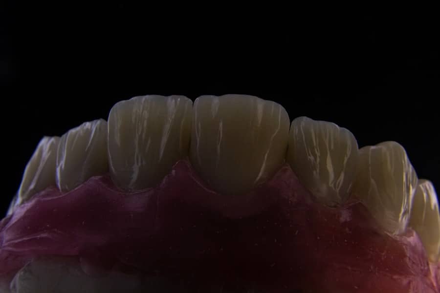 Photo Implant Dentist