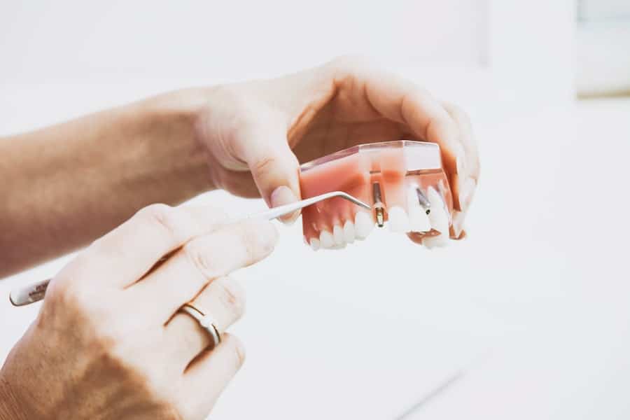 Photo Dental Implants