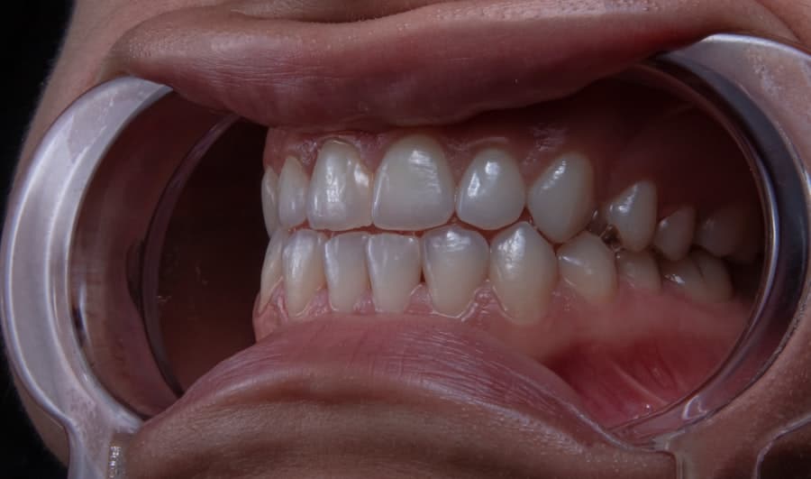 Photo Dental Implant Clinics