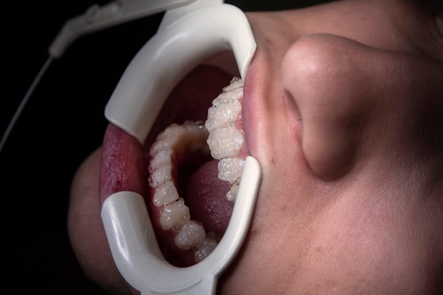 Photo Dental Implant Specialist