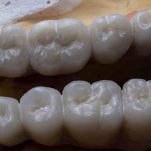 Photo Dental Restoration