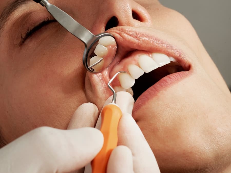 Photo Dental Implants
