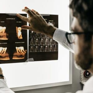 Photo Dental Implants