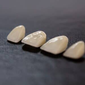 Photo Dental Implants