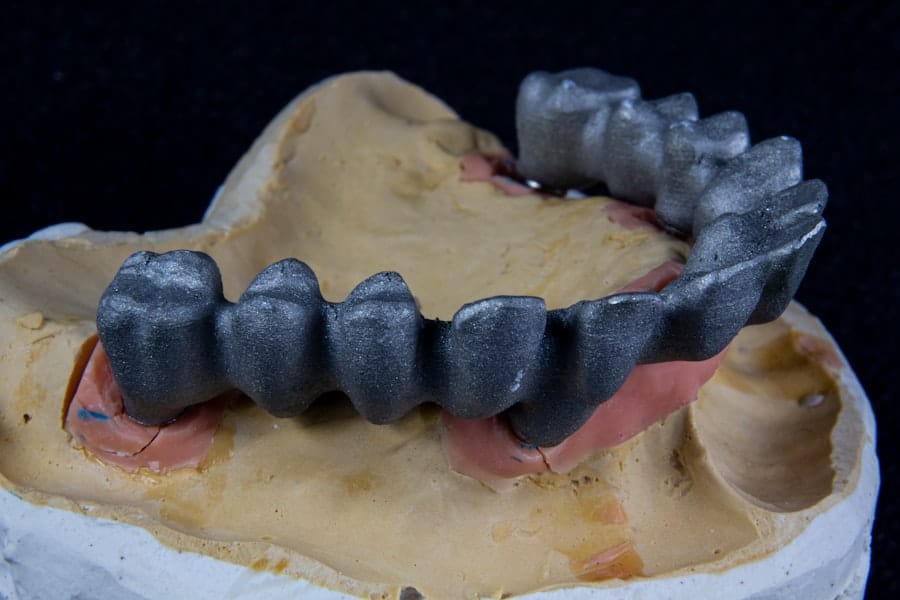 Photo Implant Dentist