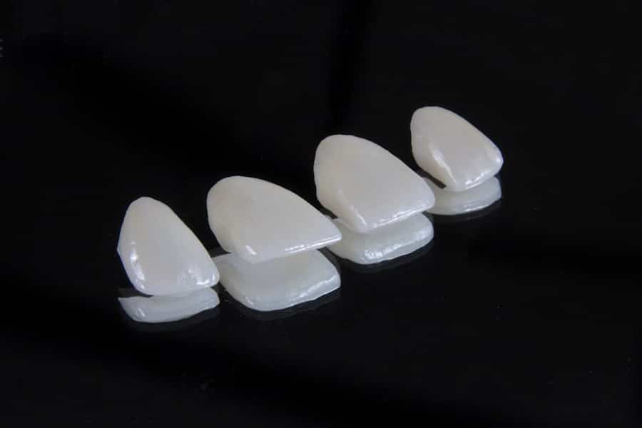 Photo Dental Implants