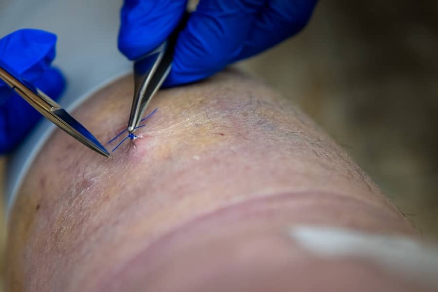 Photo Implant Clinic