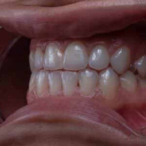 Photo Prosthodontist