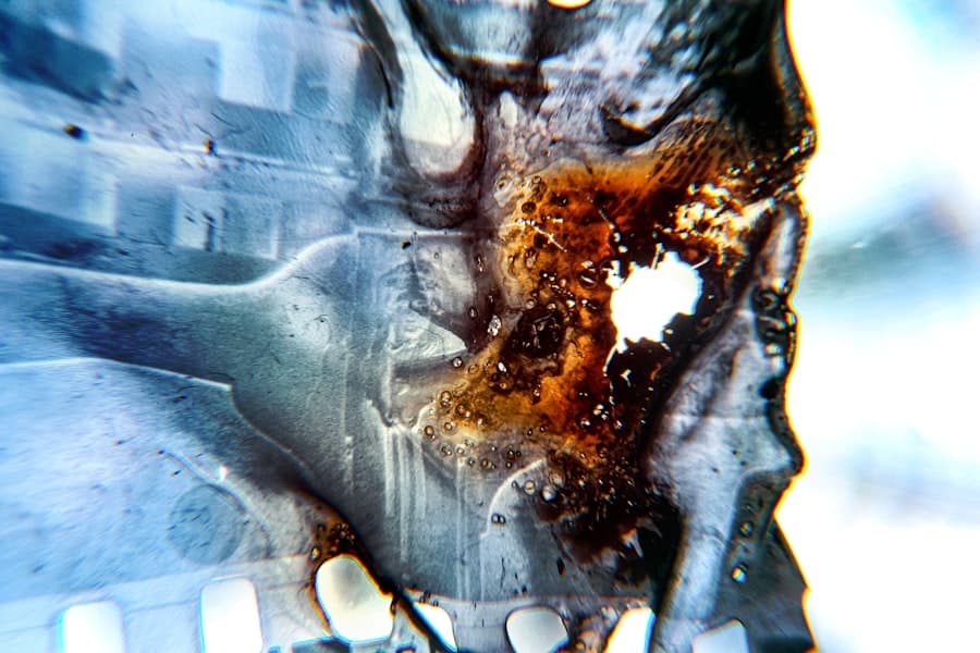 Photo Bone Graft