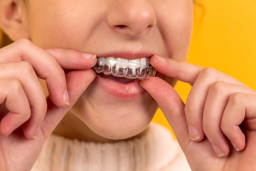 Photo Dental Implants