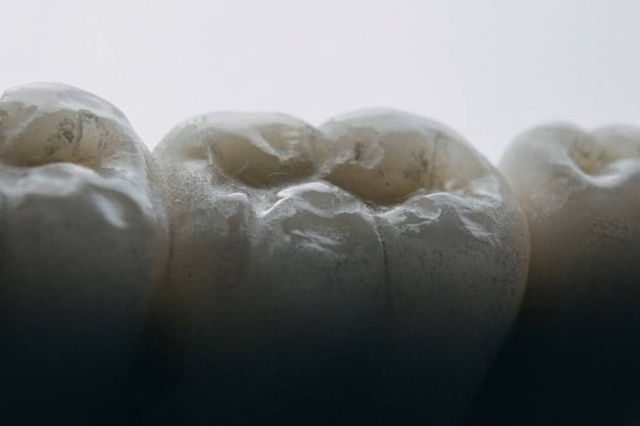 Photo Dental Implant Cost