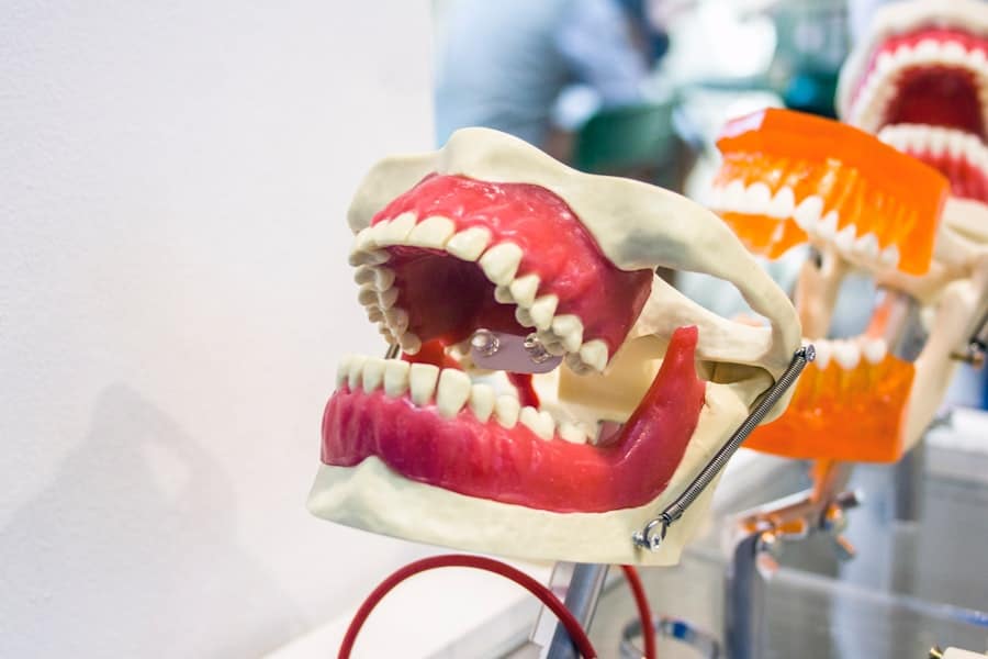 Photo Dental Implant Deals