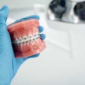 Photo Dental Implant Cost