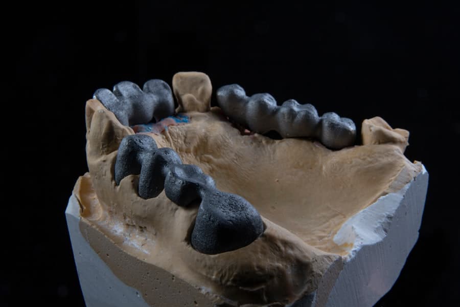 Photo Dental Implant Dentist