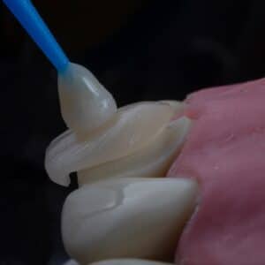 Photo Dental Implant Procedure