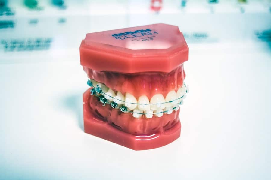 Photo Dental Implant Cost