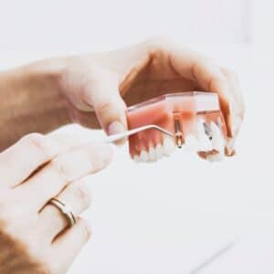 Photo Dental Implants