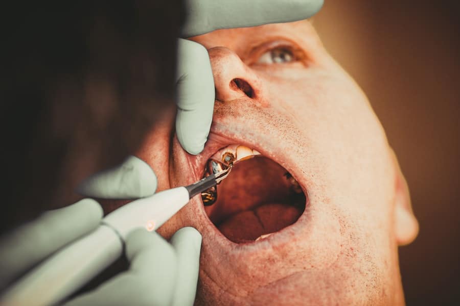 Photo Dental Implant Vs Bridge Chandler Az Cost