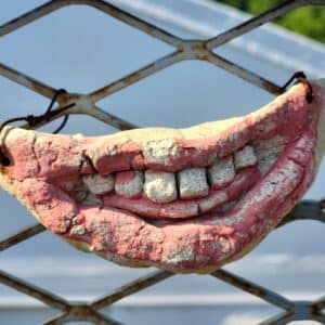 Photo Mouth Restoration