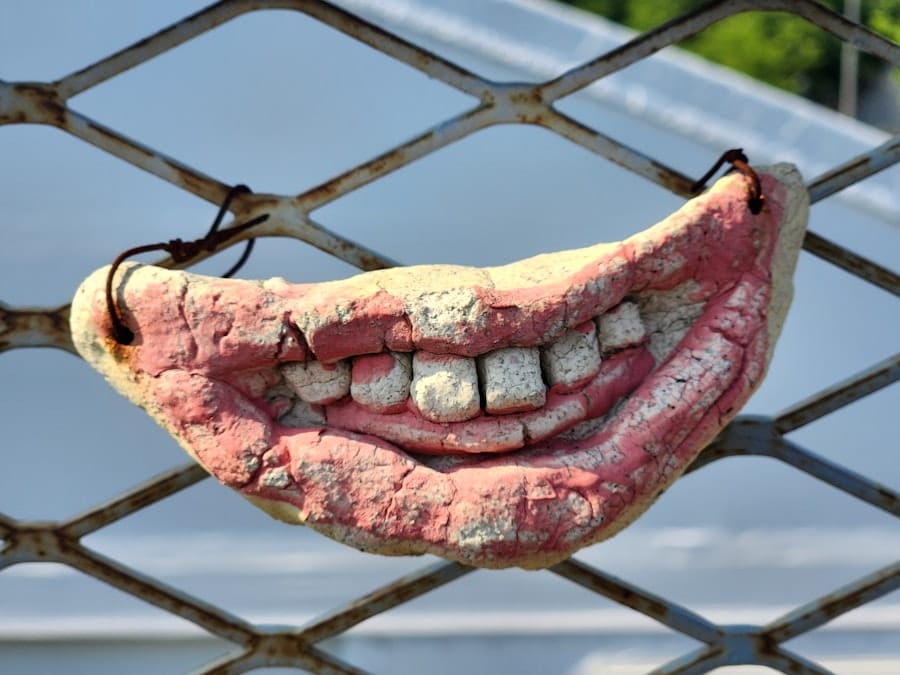 Photo Full Mouth Implants