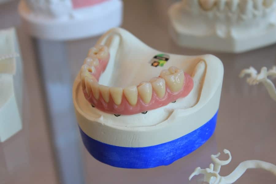 Photo Dental Implants