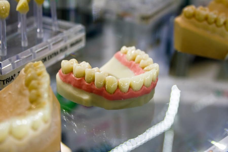 Photo Dental Restoration Cost