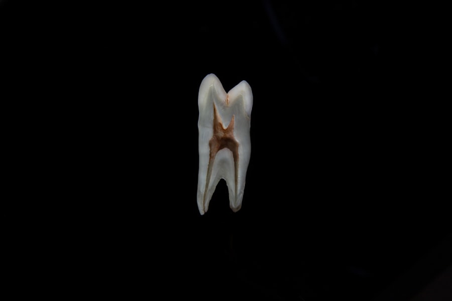 Photo Dental Implant Dentist