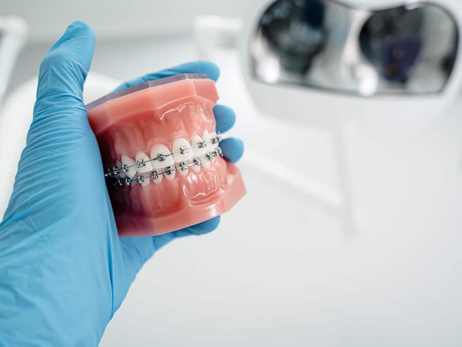 Dental Implant Financing